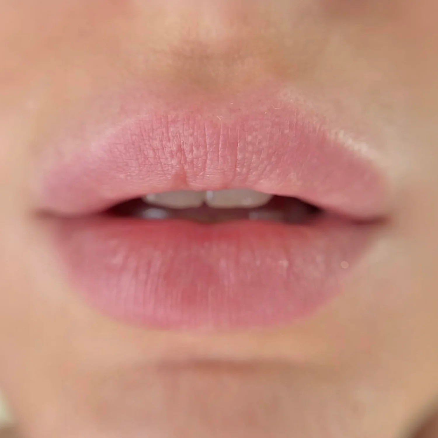 Lip Blush Vorher