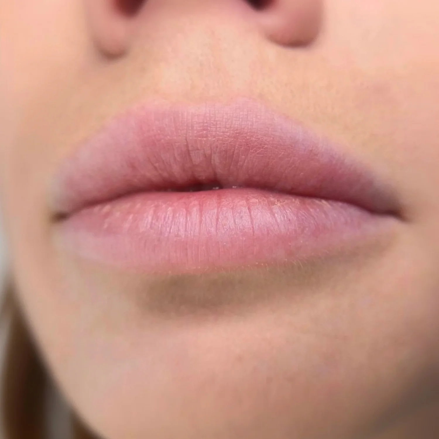 Lip Blush Vorher