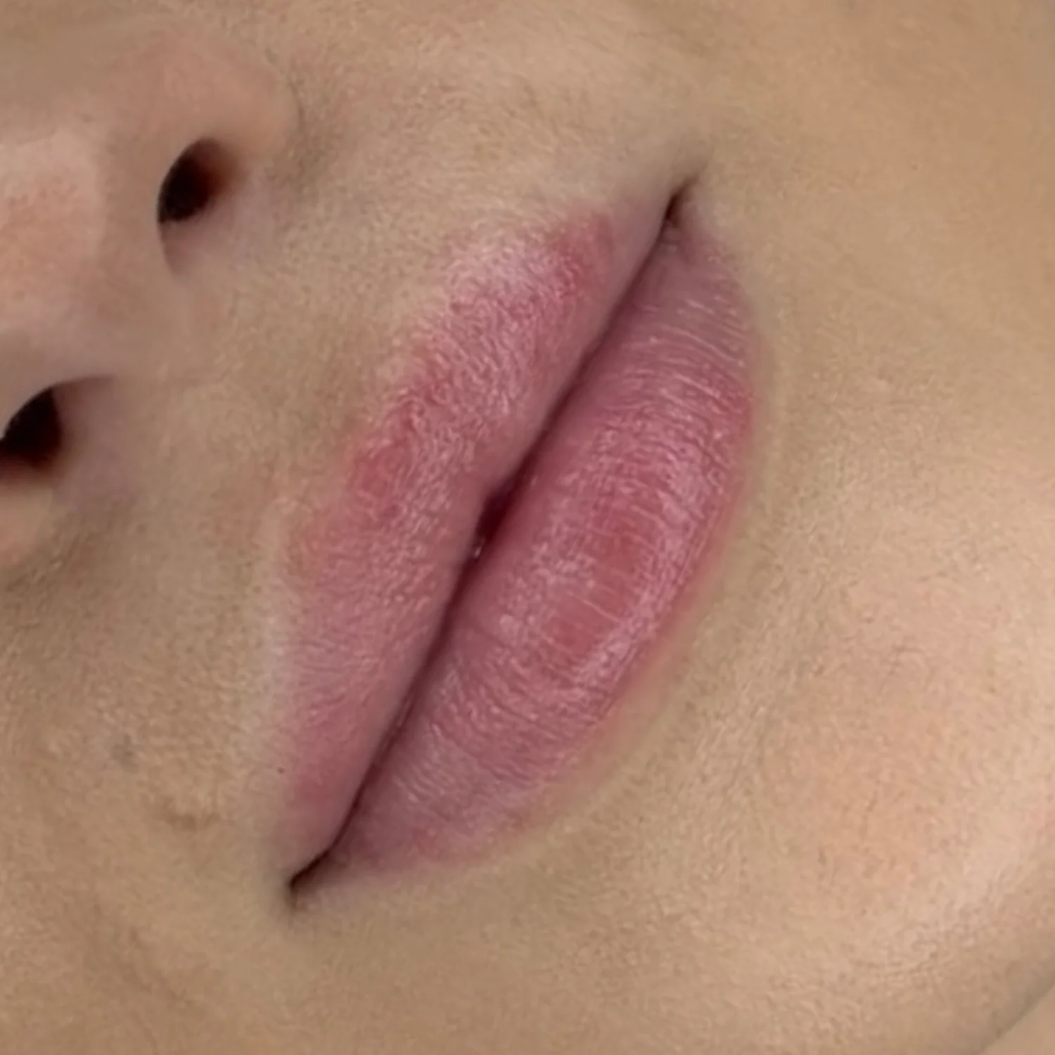 Lip Blush Vorher